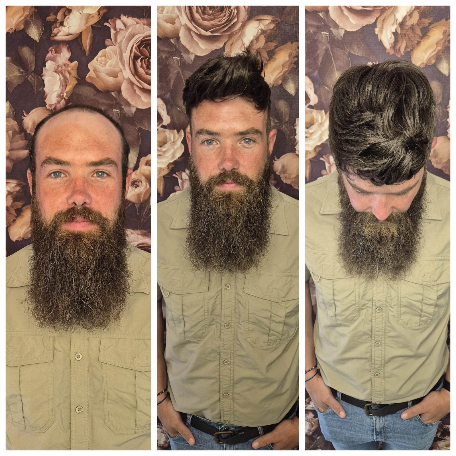 Before & After 7